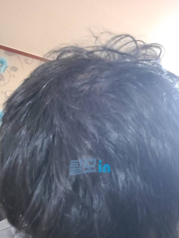 핀페시아 300정 photo review