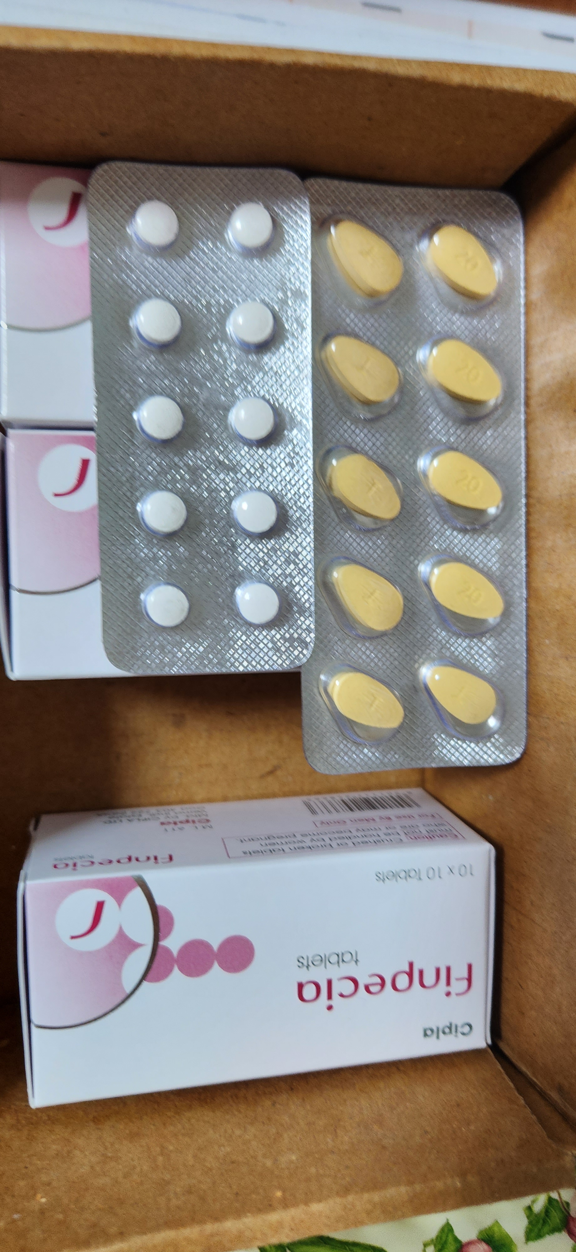 Finpecia150 photo review